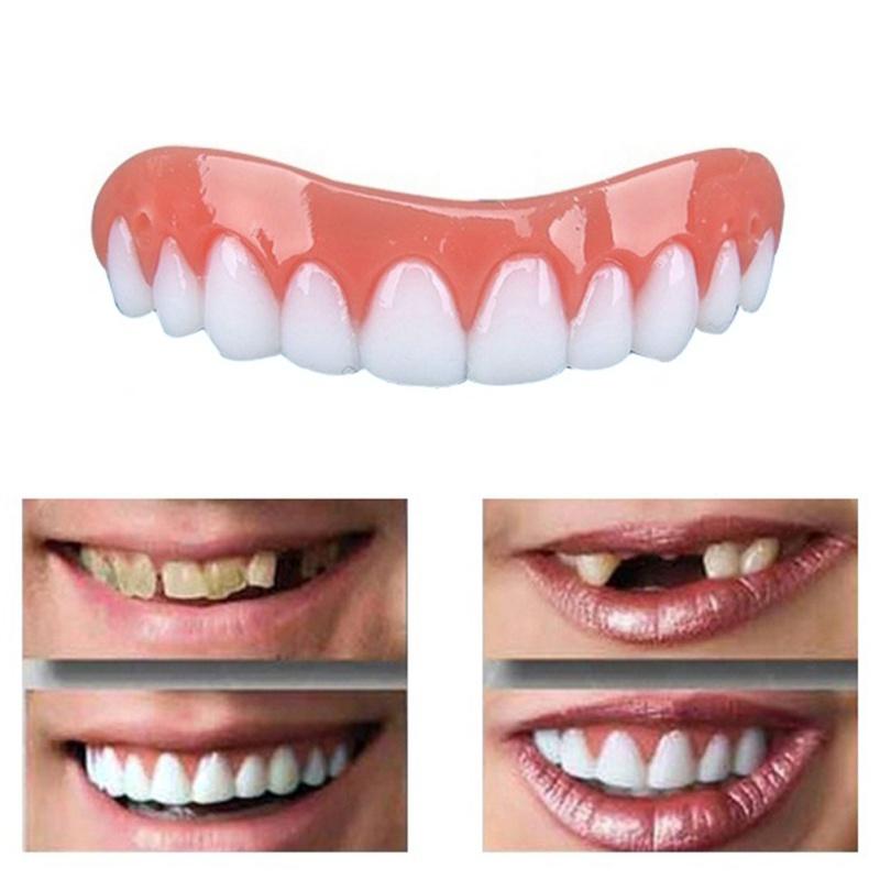 Perfect Smile Veneers Dub In Stock For Correction of Teeth For Bad Teeth Give You Perfect Smile Veneers mouth support